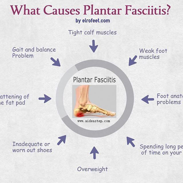 causes-of-plantar-fasciitis