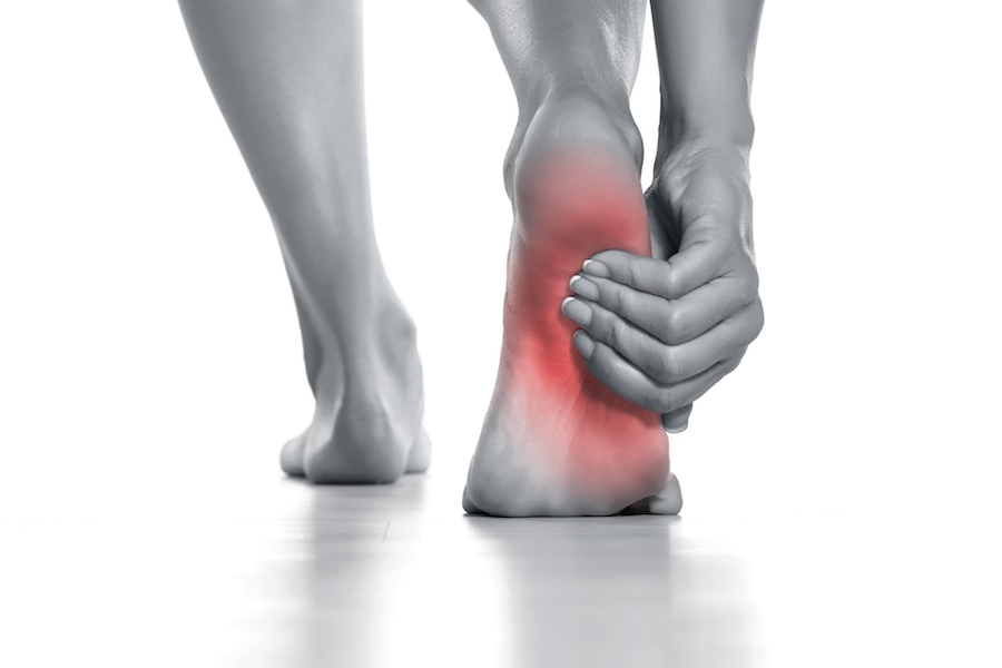 Heel Pain Plantar Fasciitis