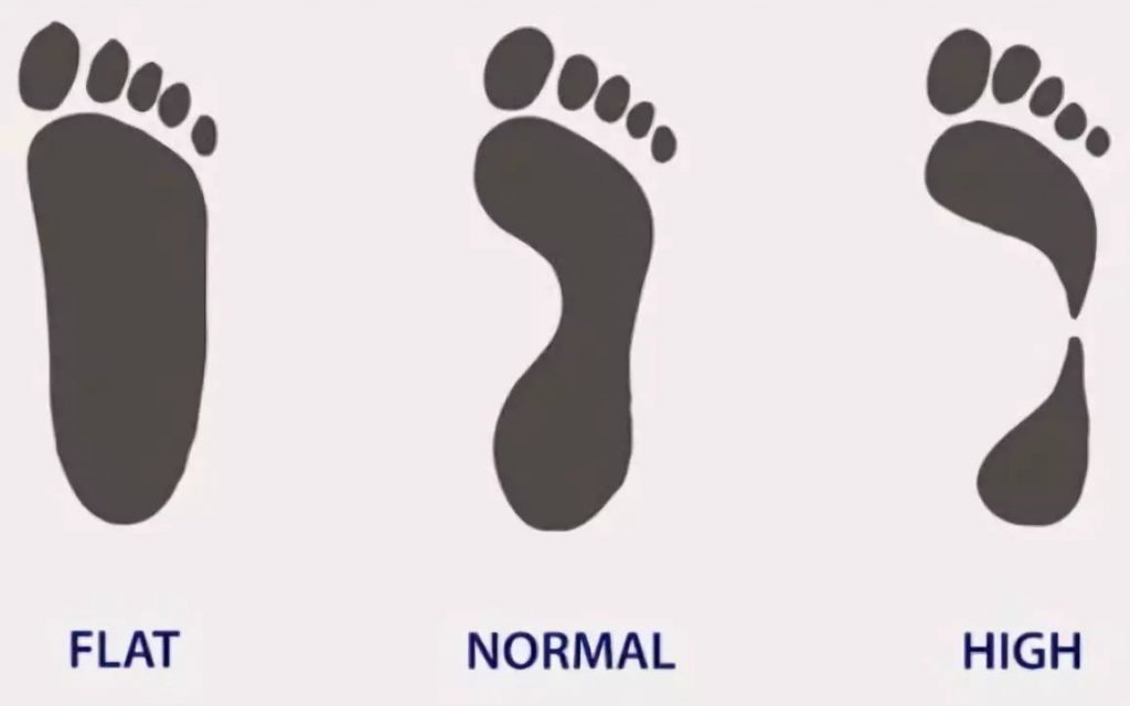 How to determine foot arch type | EVA Orthotic Insoles Manufacturer ...