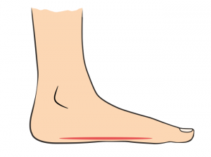 flat feet