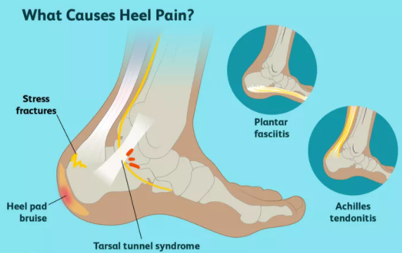 Common Foot Diseases