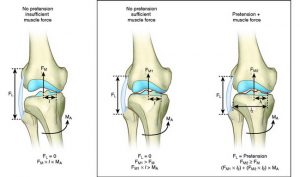 Knie Varus