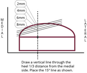 Kirby Skive | Orthotics Insoles & EVA Supplier | Ideastep