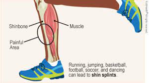 Shin Splints Explained