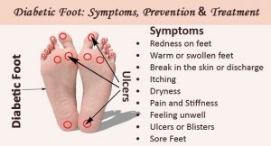 diabetic-foot