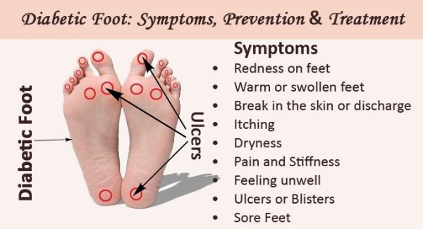 Why Are Orthotics So Important in Diabetic Foot Care? | EVA Orthotic ...