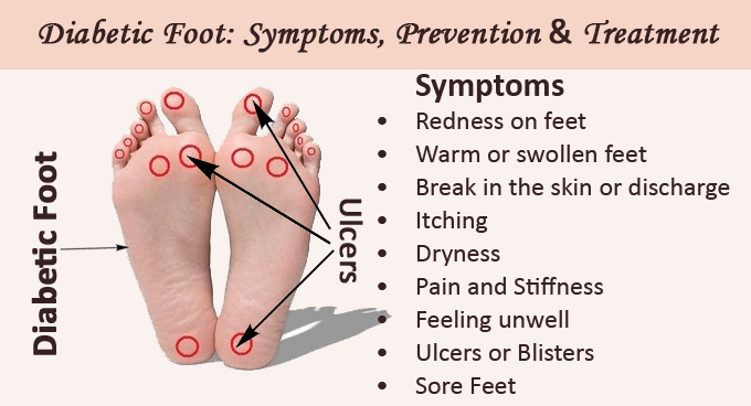 The Best Ways To Prevent Diabetic Foot Ulcers | EVA Orthotic Insoles ...