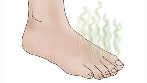 Come curare l'odore del piede