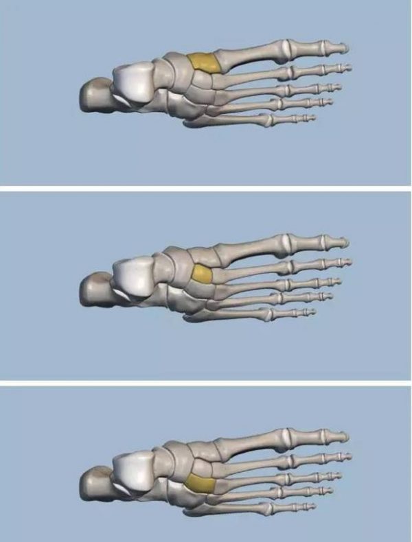 Foot Anatomy -- Tissue & Bone & Ligaments & Joint | Ideastep