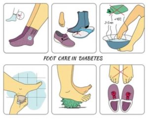 Cura del piede diabetico