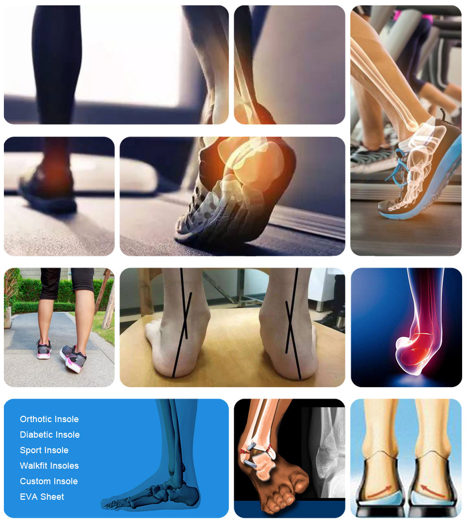 Ideastep High-quality orthotic materials suppliers for business for shoes maker