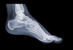 Der menschliche Fuß