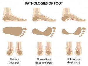 phologies of foot