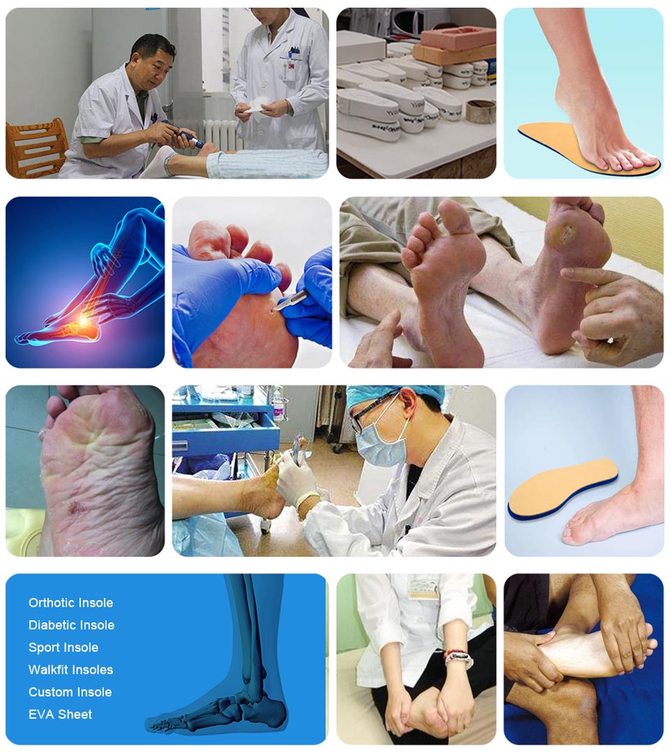 Thin eva foam removal pegs medical diabetic insoles