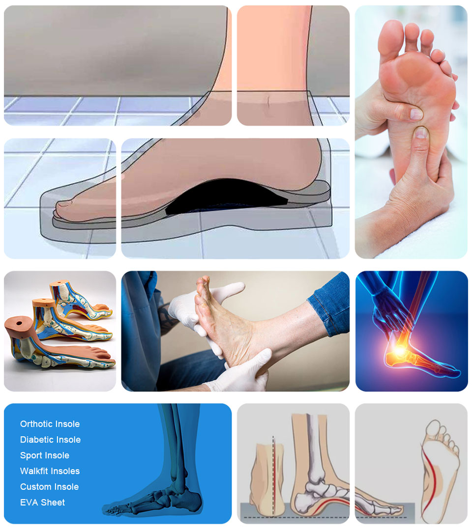 Ideastep padded insoles for shoes manufacturers for Foot shape correction