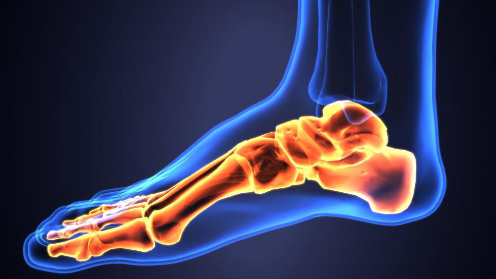 Relieve Mild Heel Pain Today with These 7 Tips