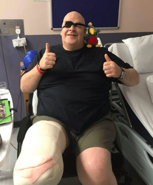 Diabetic Man Loses Leg and Shares Story to Help Others